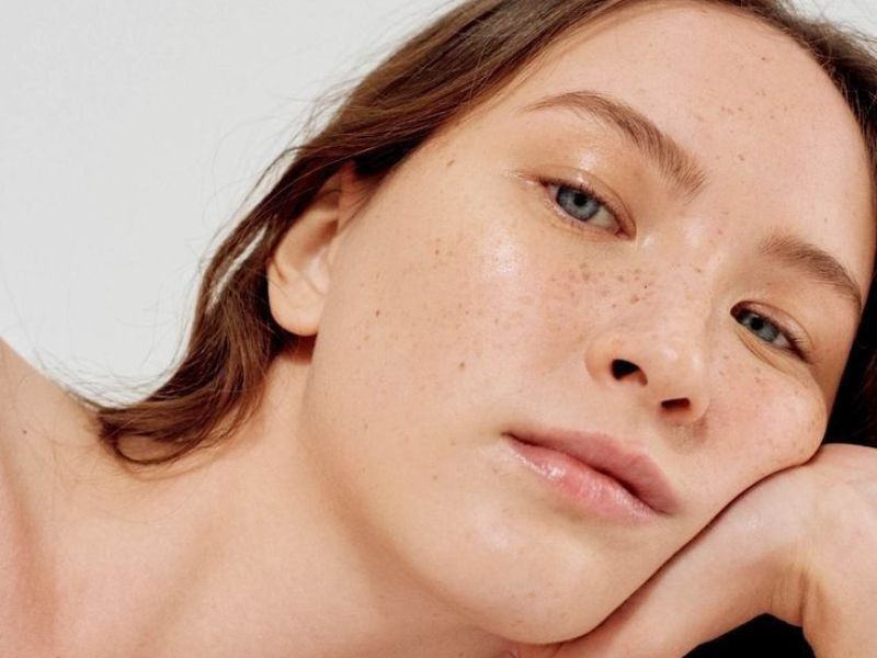 mengurangi bintik-bintik penuaan