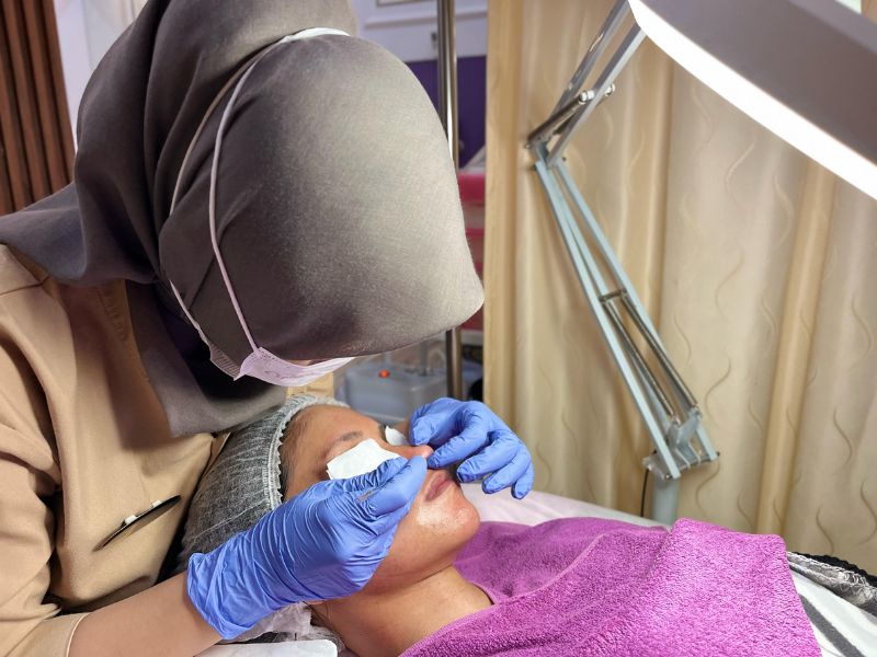 treatment untuk close komedo