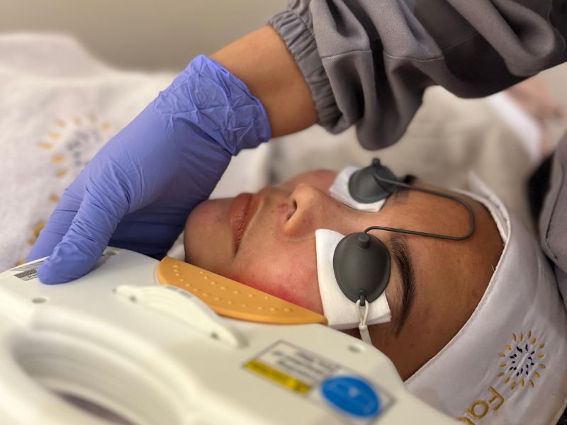 facial mesotherapy