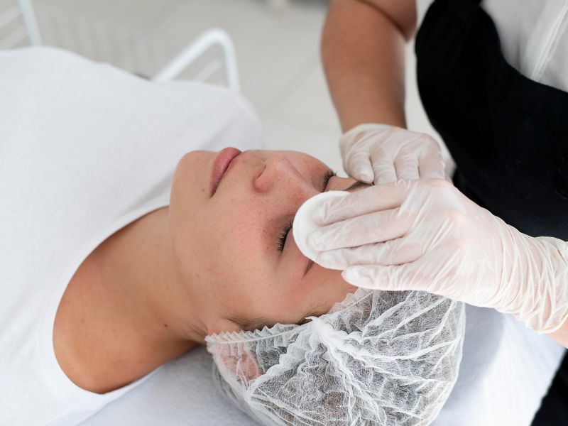 treatment kulit belang