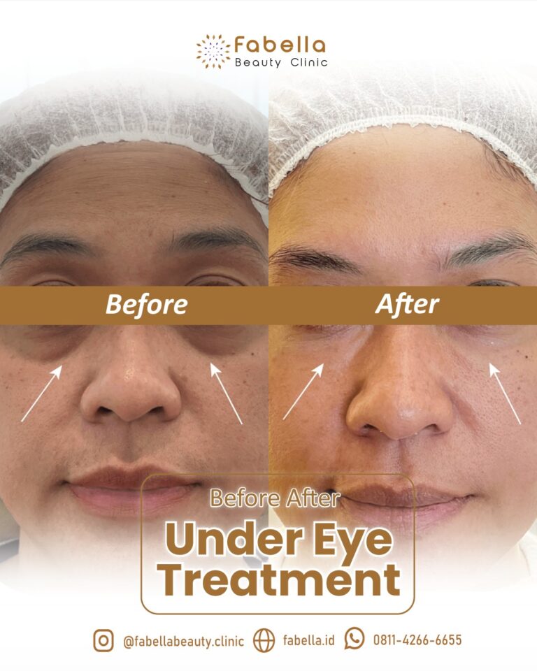 WhatsApp Image 2026-01-04 at 15.00.51