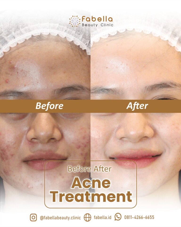 WhatsApp Image 2026-01-04 at 15.00.531