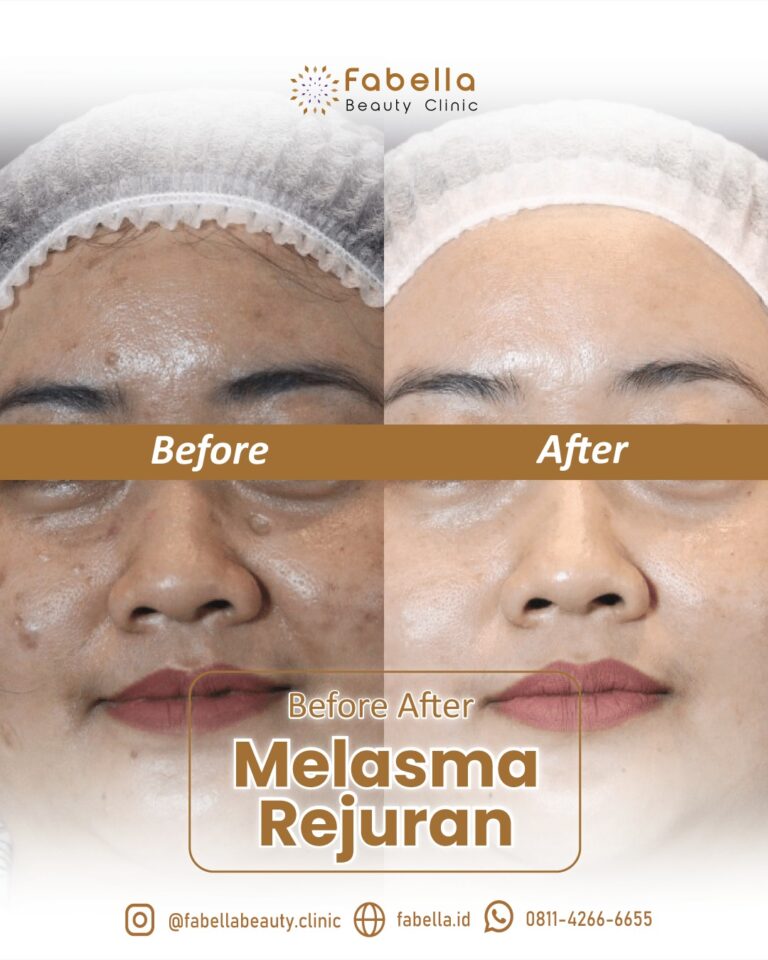 WhatsApp Image 2026-01-04 at 15.00.539