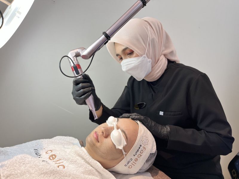 klinik laser jerawat